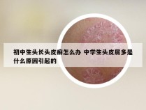 初中生头长头皮癣怎么办 中学生头皮屑多是什么原因引起的