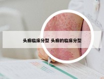 头癣临床分型 头癣的临床分型