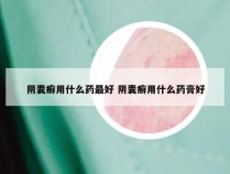 阴囊癣用什么药最好 阴囊癣用什么药膏好