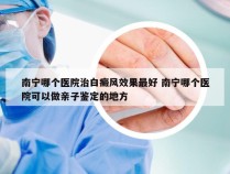 南宁哪个医院治白癜风效果最好 南宁哪个医院可以做亲子鉴定的地方