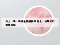 身上一块一块红色的癣很痒 身上一块块红红的像癣痒