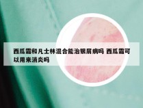 西瓜霜和凡士林混合能治银屑病吗 西瓜霜可以用来消炎吗