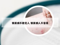 银屑病不敢见人 银屑病人不容易