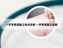 一岁多男孩腿上有点点癣 一岁男宝腿上长癣