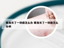 眼角长了一块癣怎么办 眼角长了一块癣怎么办啊