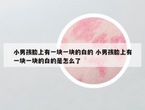 小男孩脸上有一块一块的白的 小男孩脸上有一块一块的白的是怎么了