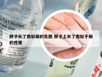 脖子长了类似癣的东西 脖子上长了类似于癣的疙瘩