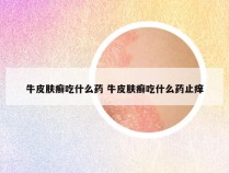 牛皮肤癣吃什么药 牛皮肤癣吃什么药止痒