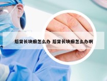 后背长块癣怎么办 后背长块癣怎么办啊