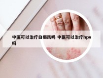 中医可以治疗白癜风吗 中医可以治疗hpv吗