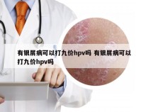 有银屑病可以打九价hpv吗 有银屑病可以打九价hpv吗