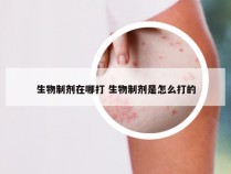 生物制剂在哪打 生物制剂是怎么打的