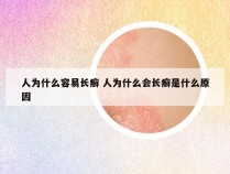 人为什么容易长癣 人为什么会长癣是什么原因