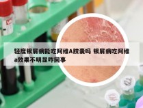 轻度银屑病能吃阿维A胶囊吗 银屑病吃阿维a效果不明显咋回事