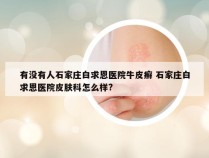 有没有人石家庄白求恩医院牛皮癣 石家庄白求恩医院皮肤科怎么样?