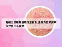 免疫力低银屑病应注意什么 免疫力低银屑病应注意什么饮食