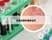 昆明白癜风最新治疗