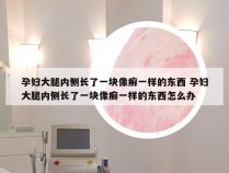 孕妇大腿内侧长了一块像癣一样的东西 孕妇大腿内侧长了一块像癣一样的东西怎么办