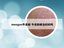 moogoo牛皮癣 牛皮肤癣治的好吗