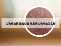 生物疗法银屑病论坛 银屑病生物疗法怎么样