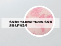 头皮癣有什么好的治疗fangfa 头皮癣用什么药物治疗