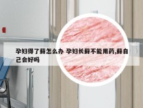 孕妇得了藓怎么办 孕妇长藓不能用药,藓自己会好吗