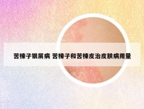 苦楝子银屑病 苦楝子和苦楝皮治皮肤病用量