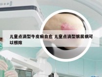 儿童点滴型牛皮癣自愈 儿童点滴型银屑病可以根除