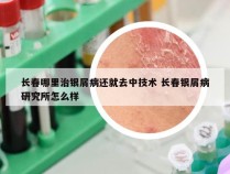 长春哪里治银屑病还就去中技术 长春银屑病研究所怎么样