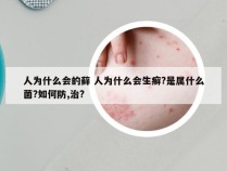 人为什么会的藓 人为什么会生癣?是属什么菌?如何防,治?