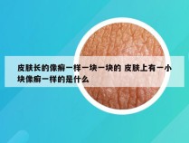 皮肤长的像癣一样一块一块的 皮肤上有一小块像癣一样的是什么