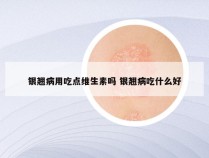 银翘病用吃点维生素吗 银翘病吃什么好