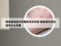 银屑病泡澡中药要煎多长时间 银屑病中药泡澡有什么效果