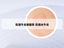 乾隆牛皮癣图章 乾隆水牛皮