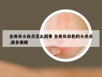 全身长小白点怎么回事 全身长白色的小点点,很多很痒