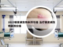 2023银屑病生物制剂价格 治疗银屑病生物制剂价格