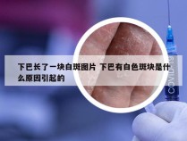 下巴长了一块白斑图片 下巴有白色斑块是什么原因引起的