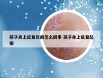 孩子身上反复长癣怎么回事 孩子身上反复起癣