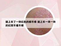 腿上长了一块红色的癣不痒 腿上长一块一块的红斑不痛不痒