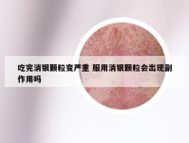 吃完消银颗粒变严重 服用消银颗粒会出现副作用吗