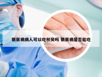 银屑病病人可以吃秋癸吗 银屑病是否能吃