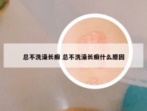 总不洗澡长癣 总不洗澡长癣什么原因