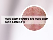 点滴型银屑病治愈后会复发吗 点滴型银屑病治愈后会复发吗女性