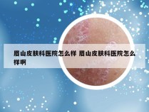 眉山皮肤科医院怎么样 眉山皮肤科医院怎么样啊