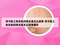 孩子脸上有白色的斑点是怎么回事 孩子脸上有白色的斑点是怎么回事图片