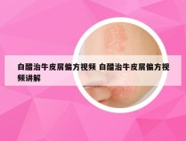 白醋治牛皮屑偏方视频 白醋治牛皮屑偏方视频讲解