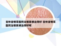 吉林省哪家医院治银屑病治得好 吉林省哪家医院治银屑病治得好呢