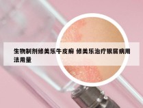 生物制剂修美乐牛皮癣 修美乐治疗银屑病用法用量