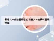 长春八一皮肤医院地址 长春八一皮肤科医院地址