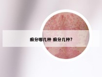 癣分哪几种 癣分几种?